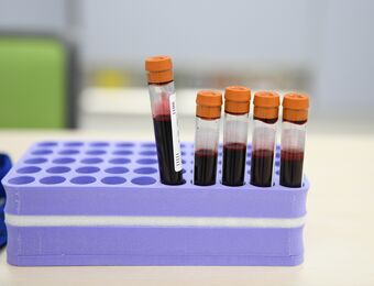 relates to GLP-1s Become a Target for Blood Testing Companies as Covid Testing Declines