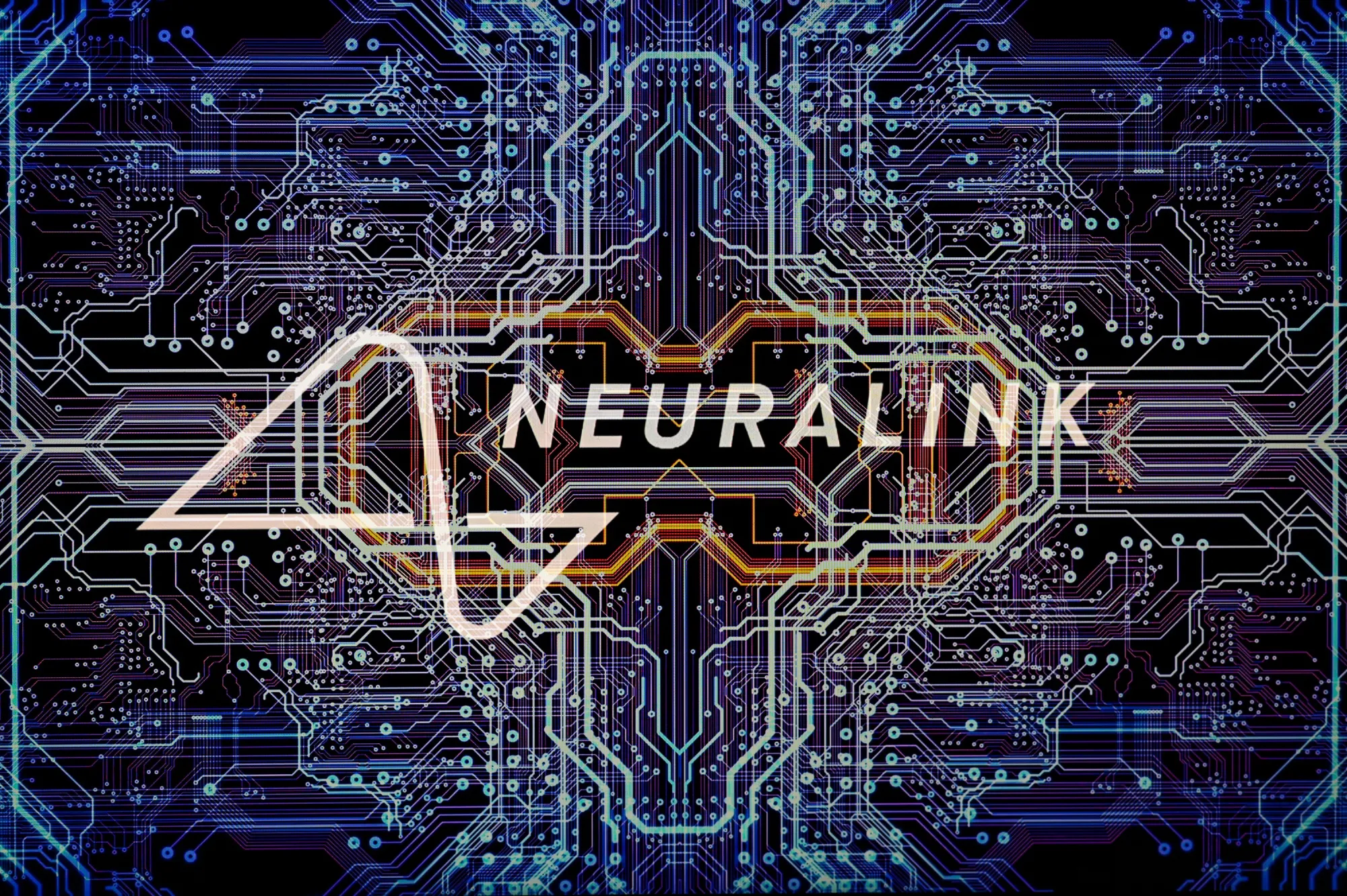 Neuralink  Illustration