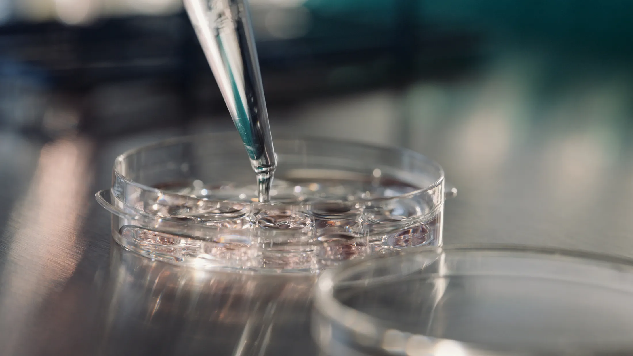 IVM culture dish that is used in Fertilo protocol being prepared.