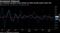 U.S. business equiment orders picked up while durable goods orders fell