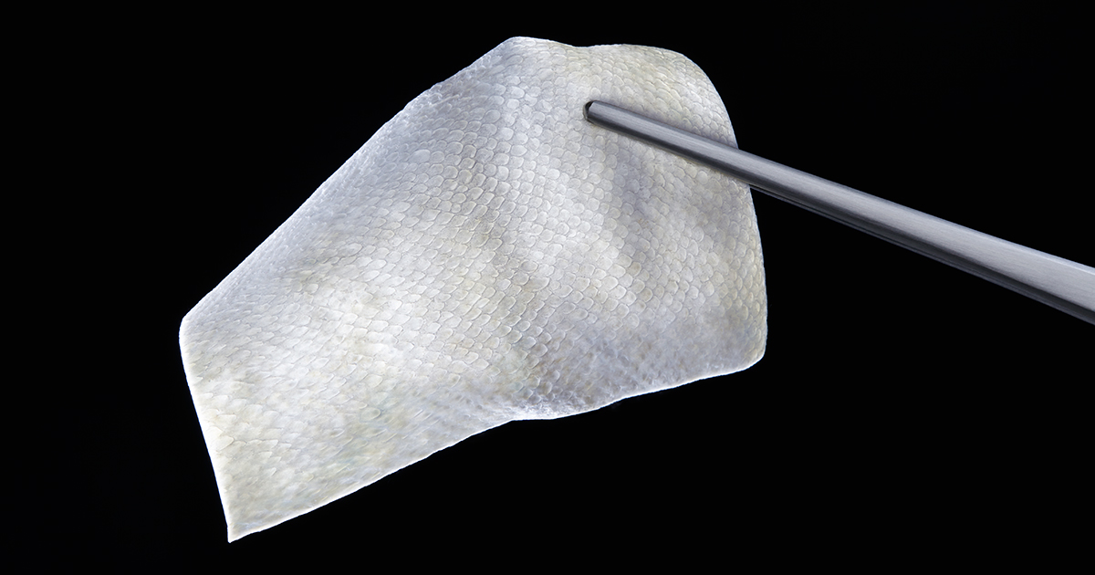 Fish Skin May Be the Answer to Chronic Wounds Bloomberg