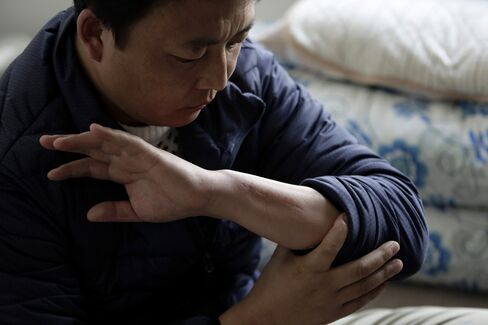 Zhang Wenkun shows his injury