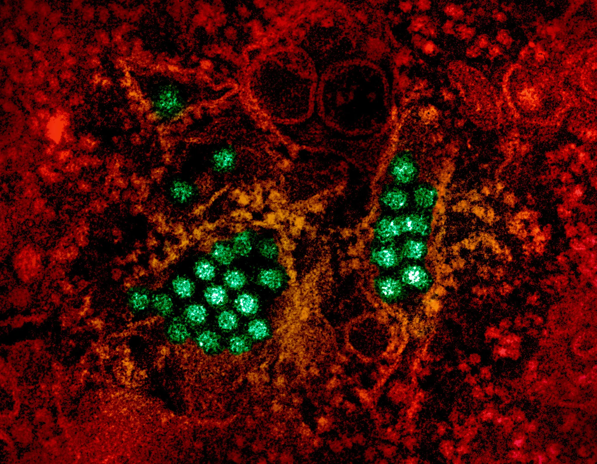 Dengue virus particles.