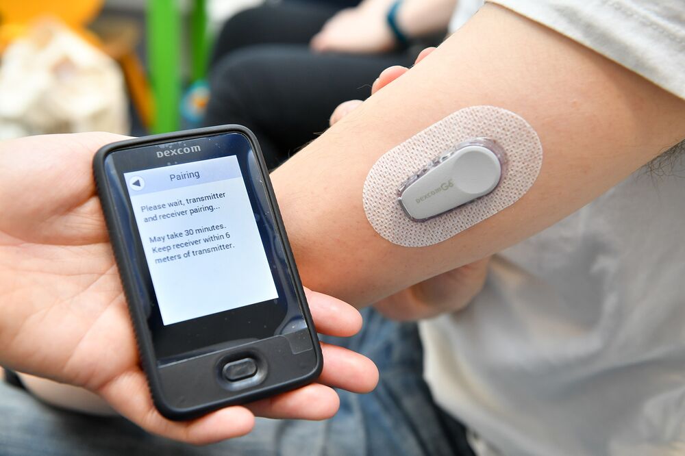 A Dexcom G6 Continuous Glucose Monitoring (CGM) System