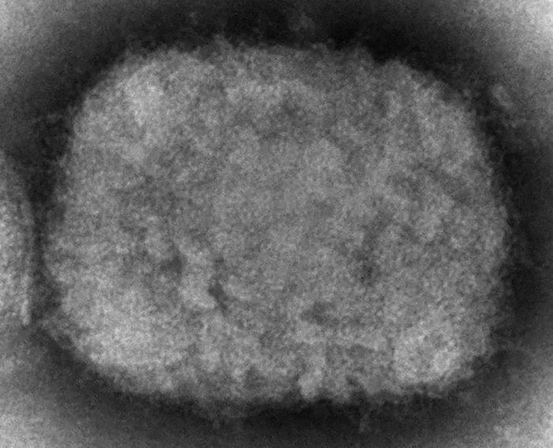 An electron microscope image showing&nbsp;a monkeypox virion.&nbsp;