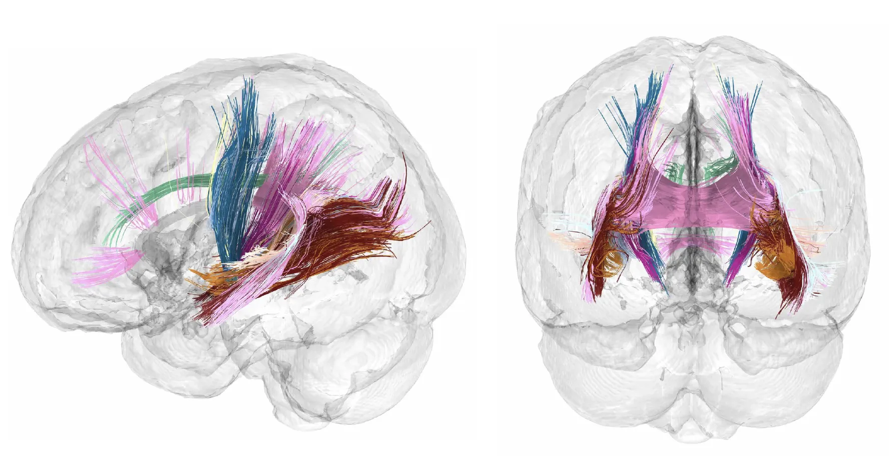 Pregnancy brain