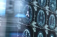 Neurology research, conceptual image RF