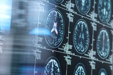 Neurology research, conceptual image RF