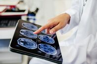 relates to 中国が脳インプラントの臨床試験実施、米国に続き成功と現地紙