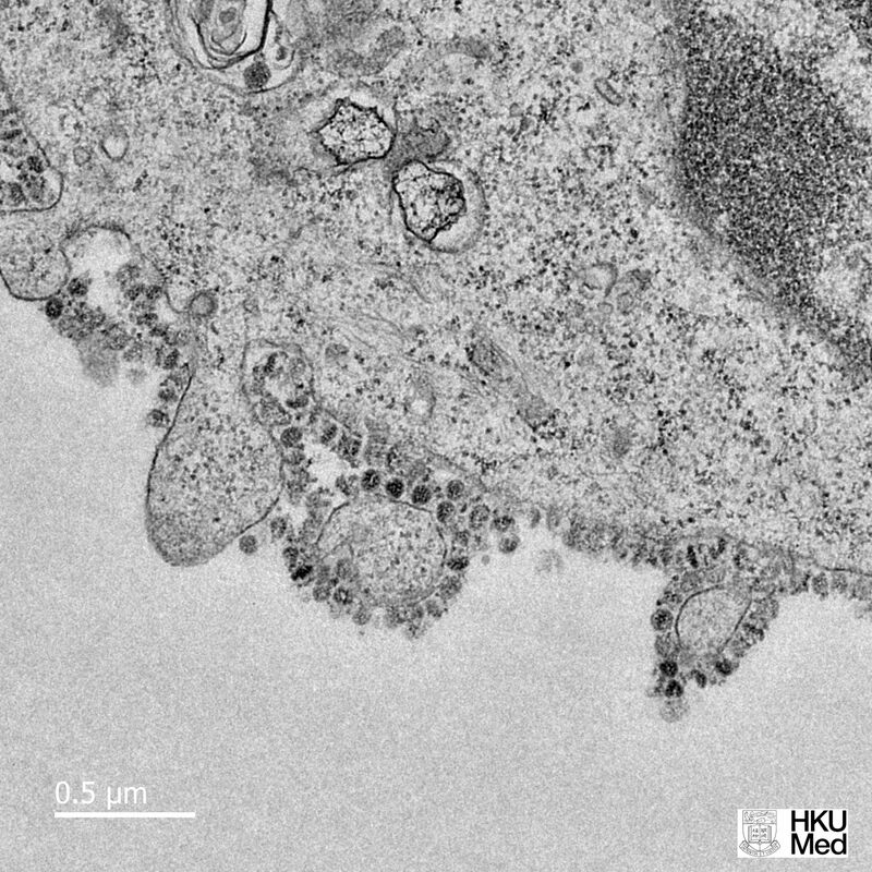 An electron microscopic image of the 2019 novel coronavirus grown in cells at The University of Hong Kong.