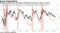 Flattening yield curve coincides with dimmer consumer views of future