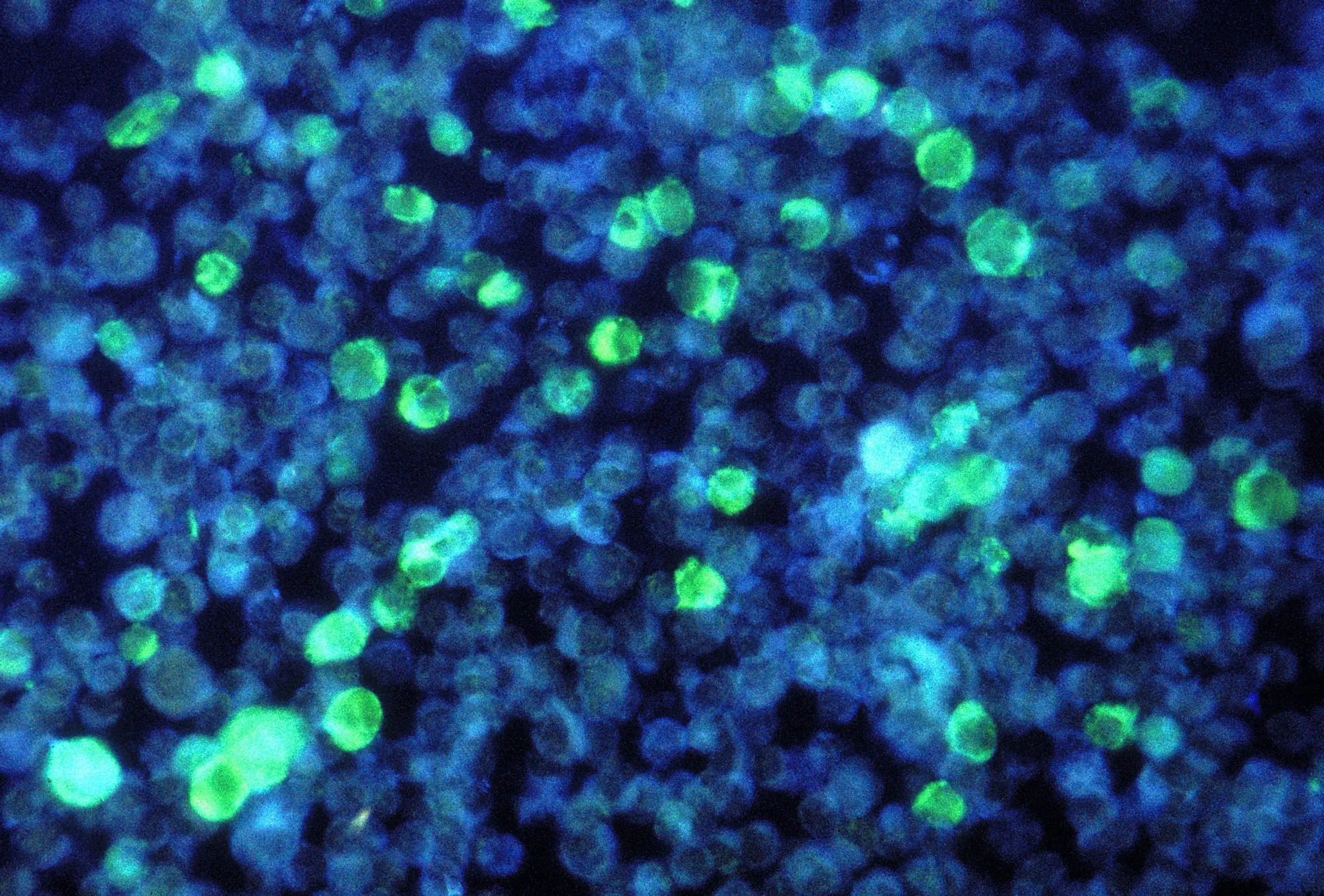 Photomicrograph depicting&nbsp;cells that contain Epstein Barr virus.