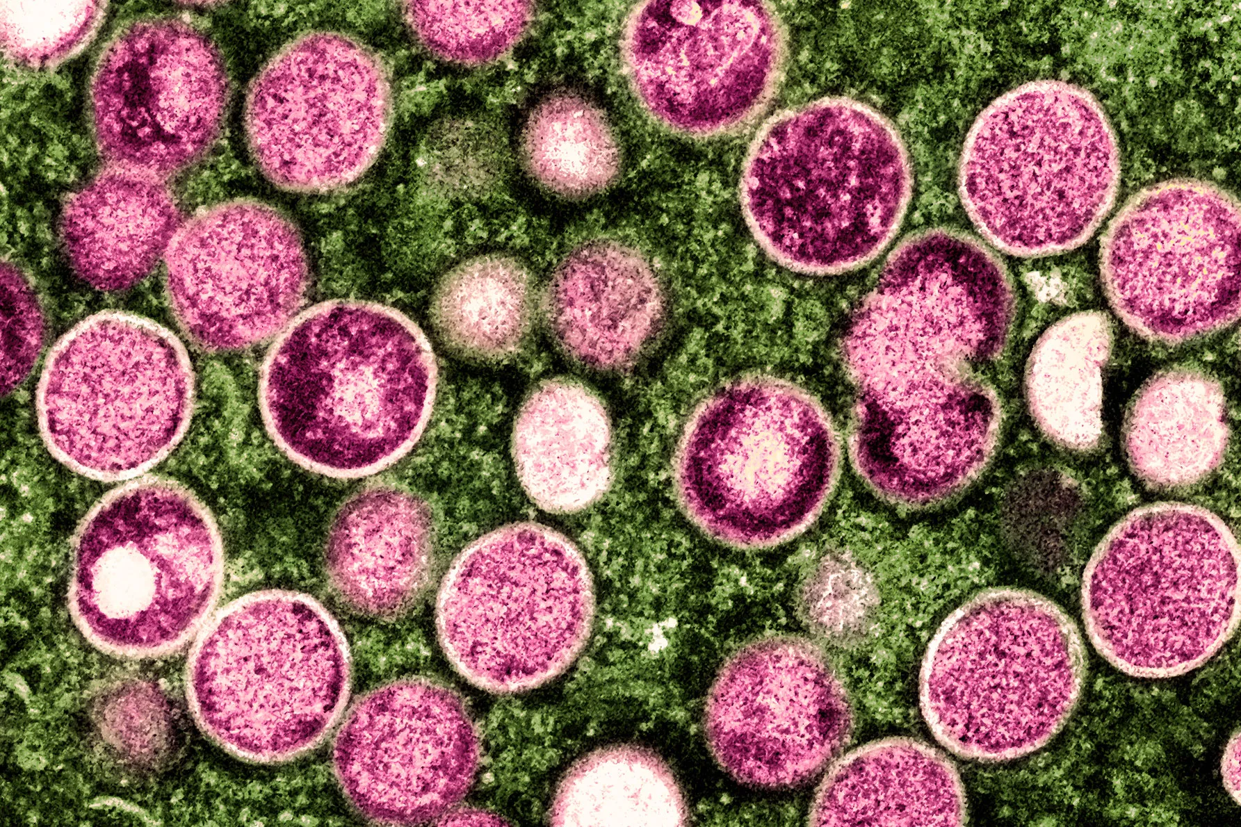 An electron micrograph of mpox virus particles.