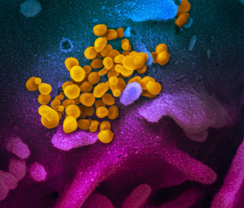 relates to Coronavirus Microscope Images Published by U.S. Researchers