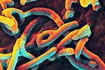 Scanning electron micrograph of the Ebola virus