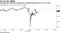 AstraZeneca's American depositary receipts fluctuated on the trial news