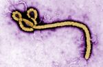 An Ebola virus virion.