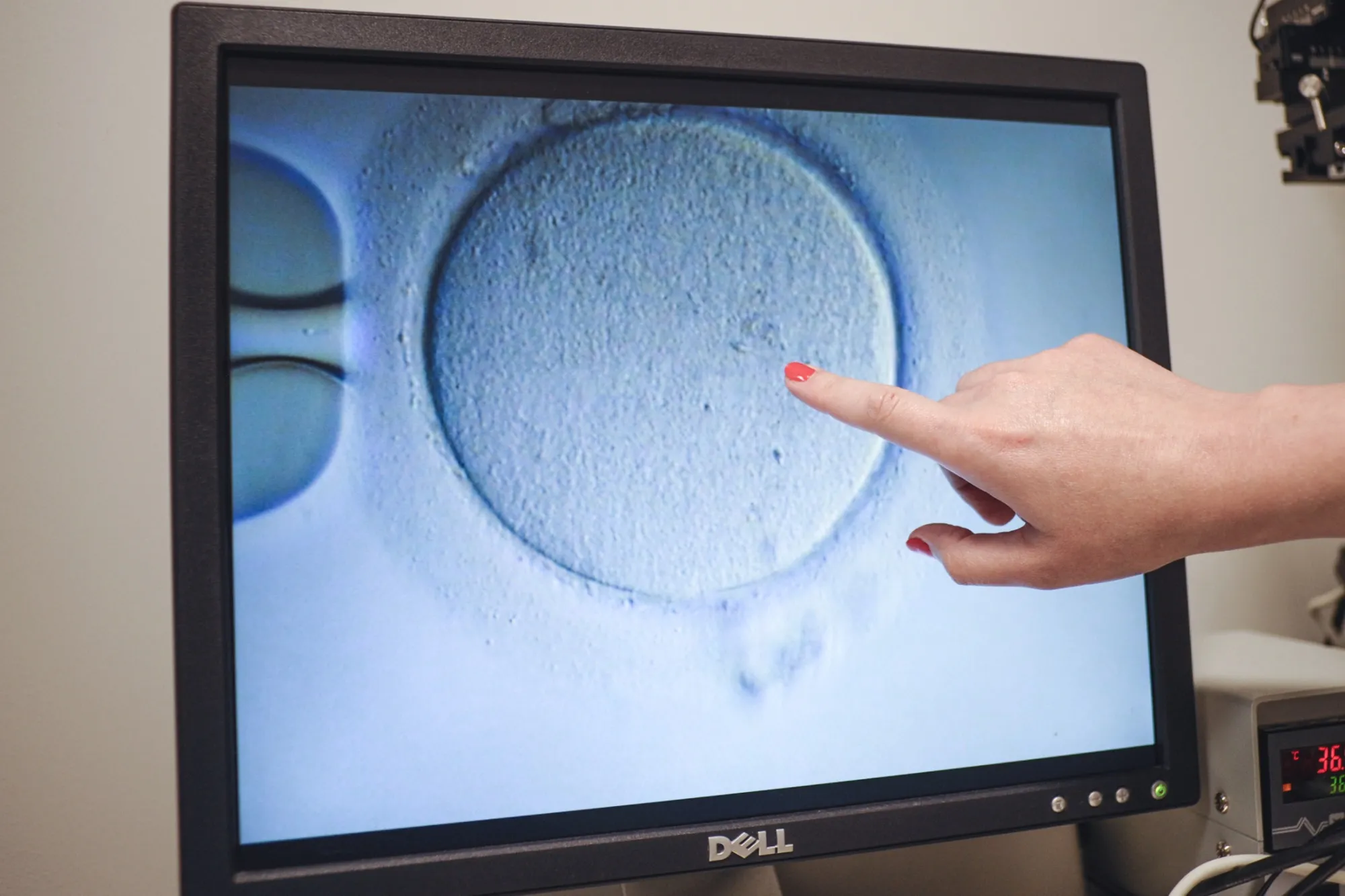 The Centers for Disease Control&nbsp;data had formed the backbone of research that has driven in vitro fertilization’s rapid evolution.