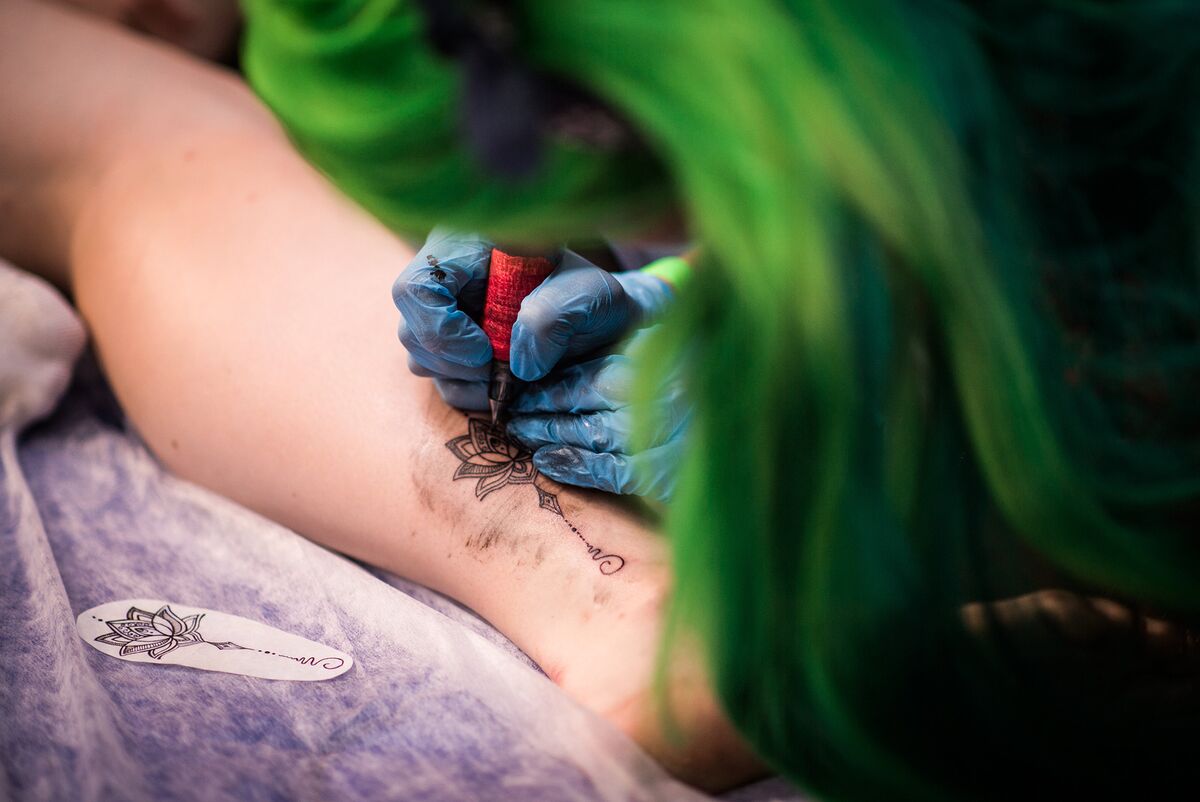 Medtech Firm Extends 300% Surge on Cellulite, Tattoo Device Hope