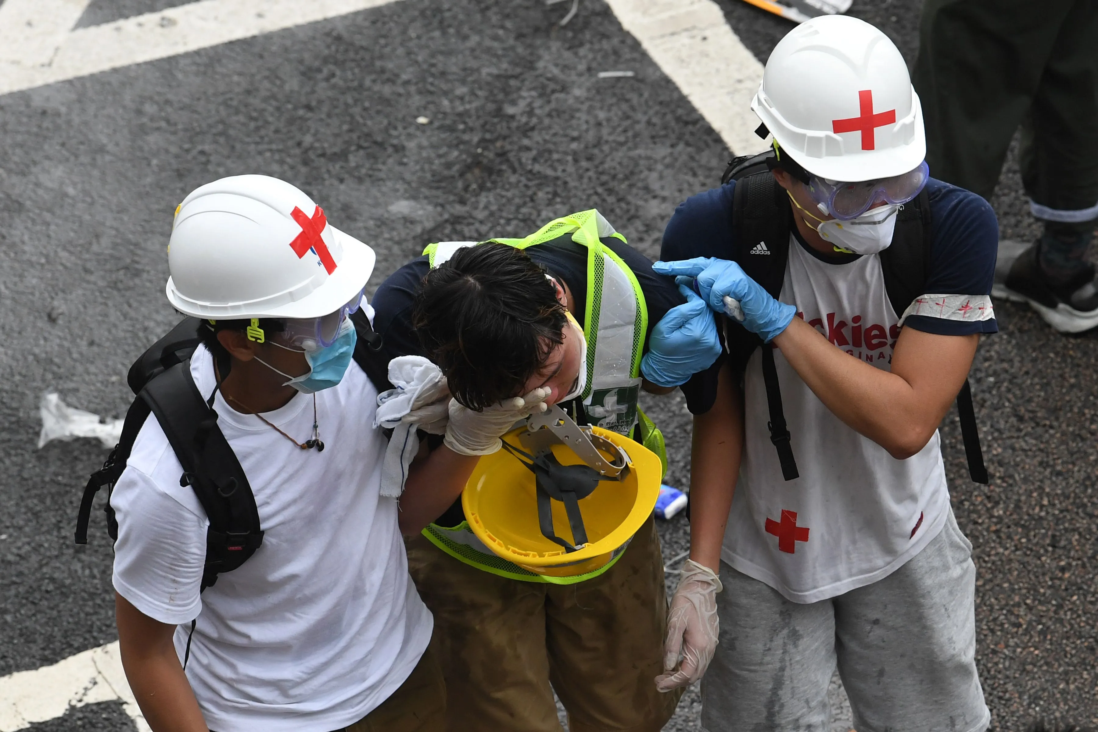 Hard hats can’t protect against all damage.