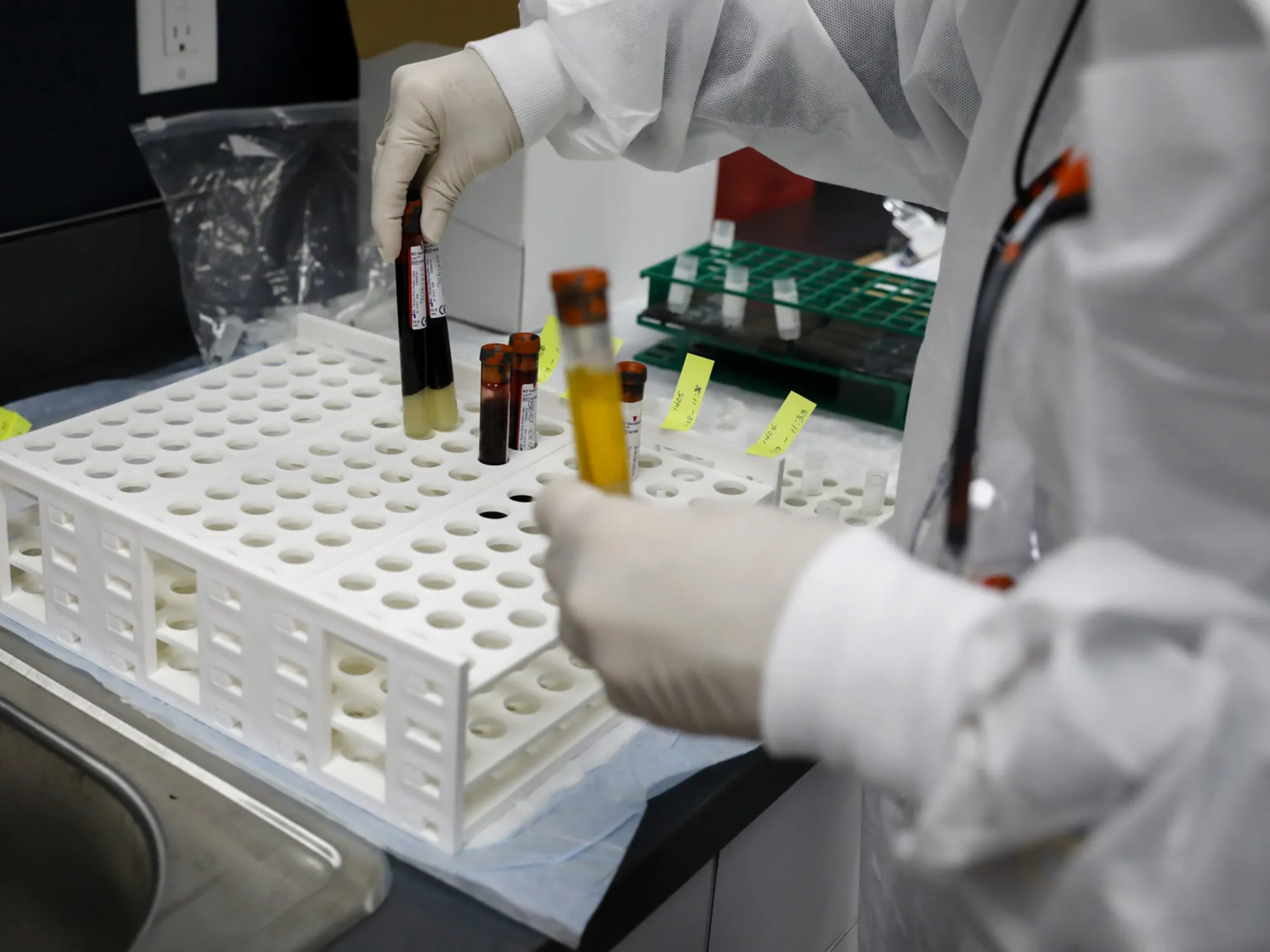 A health worker handles blood samples during clinical trials for a Covid-19 vaccine in Hollywood, Florida.