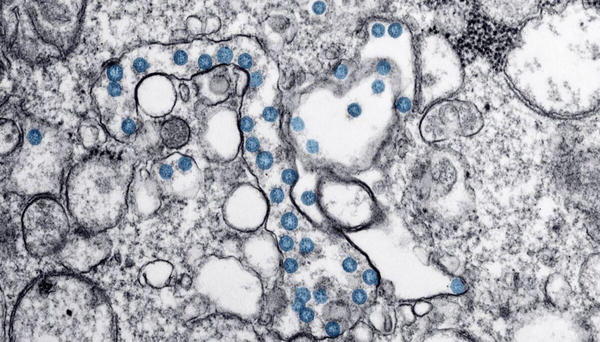 Scientists Create mAb Antibody That Defeats Coronavirus in Lab