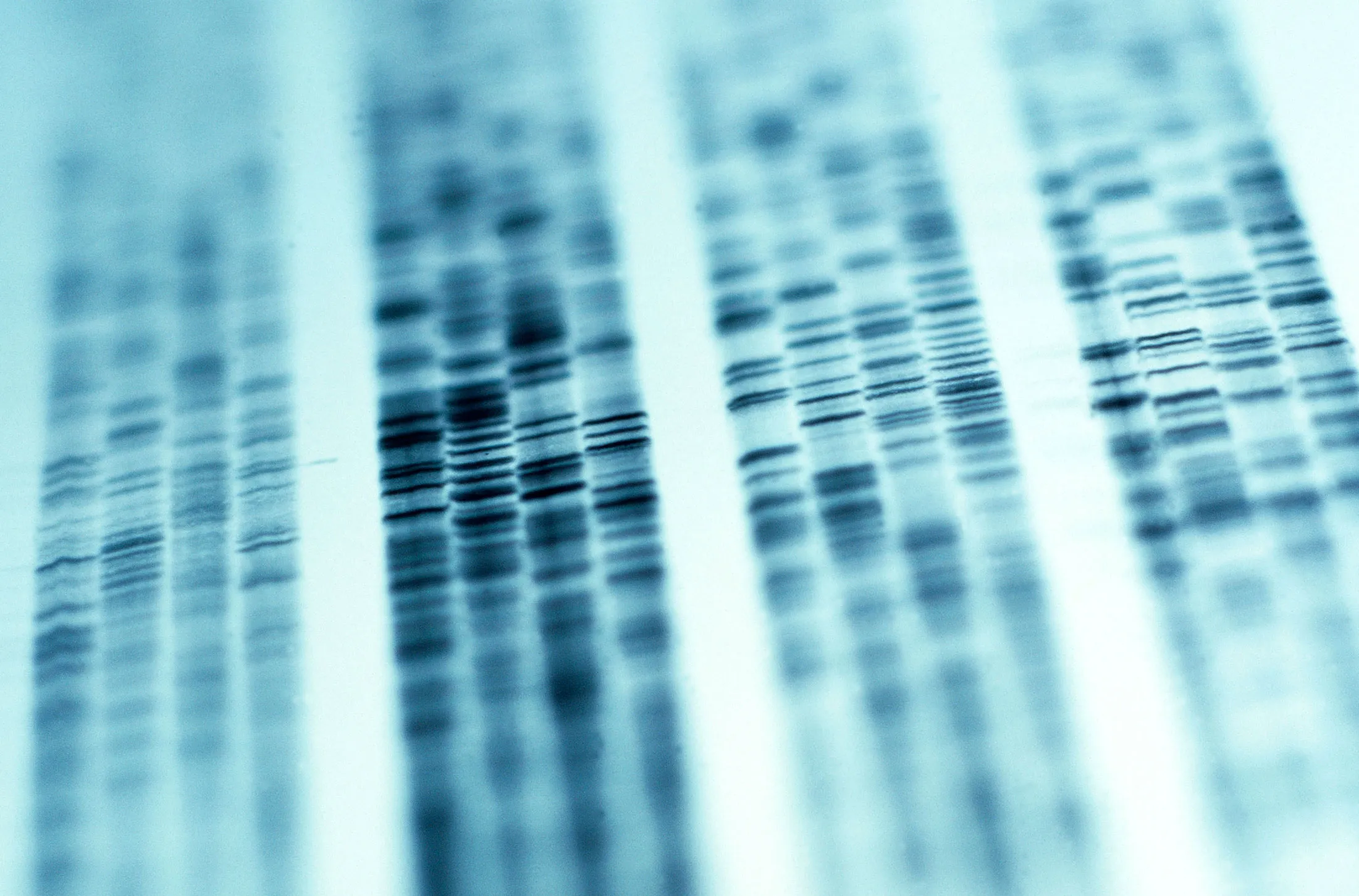 Sobi is focusing on its next-generation blood-clotting treatments and plans to introduce Elocta for hemophilia A by the end of this year and Alprolix for hemophilia B in the second half of 2016.
