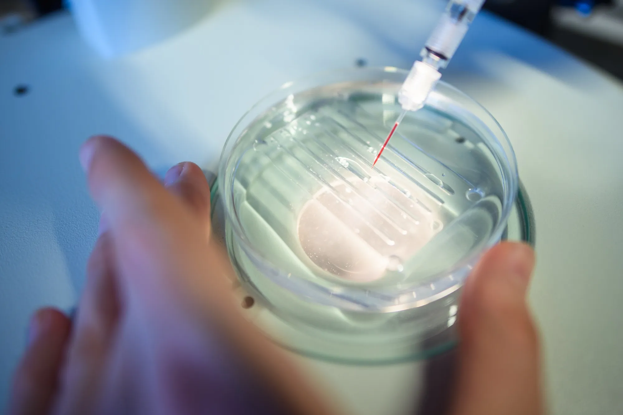 A researcher performs a Crispr procedure, a gene-altering process that’s part of one treatment for sickle cell disease.