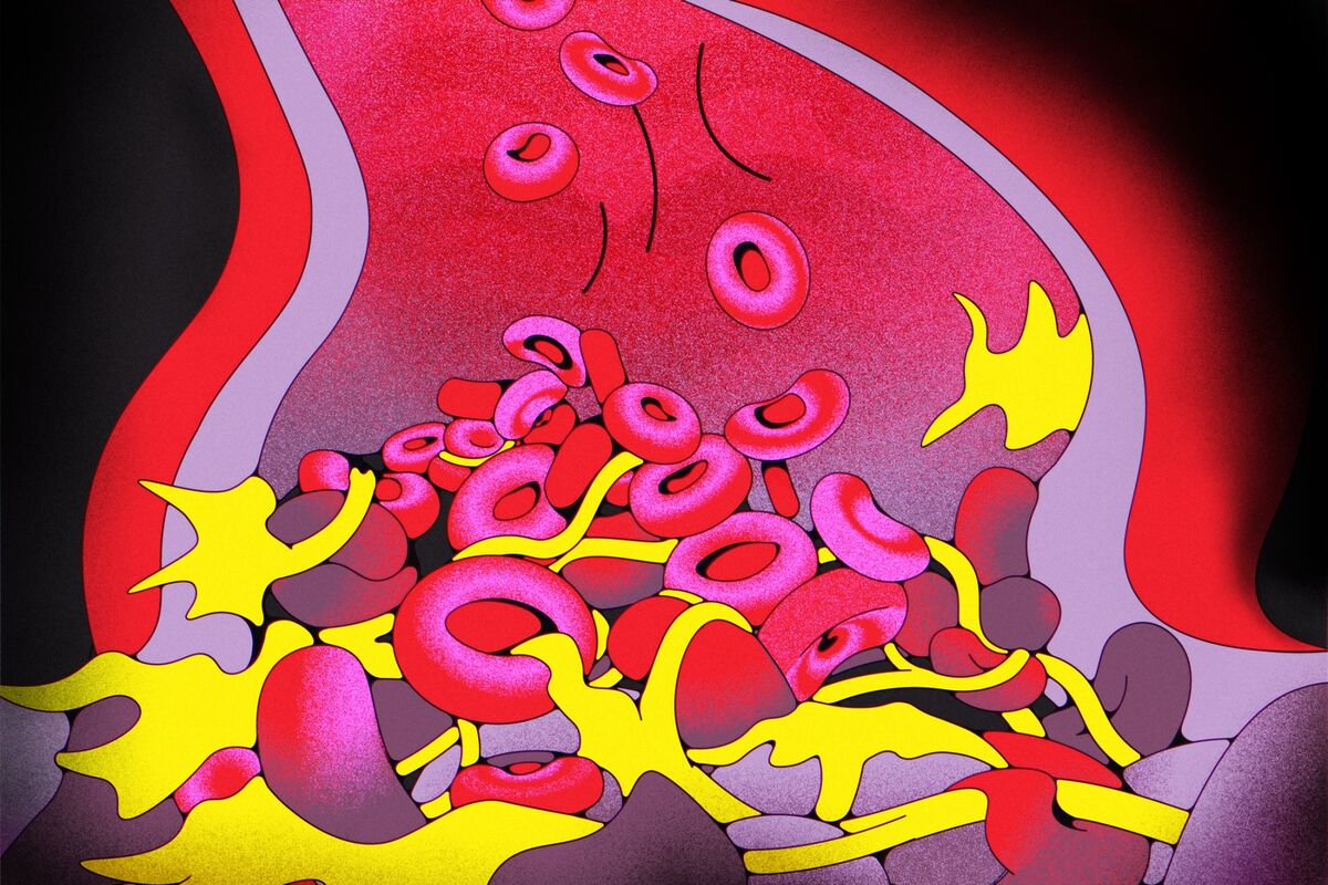 Blood Clots Have Big Pharma Chasing 55 Billion Market Bloomberg   1200x800 