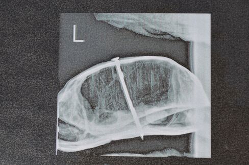 Box Turtle X-Ray