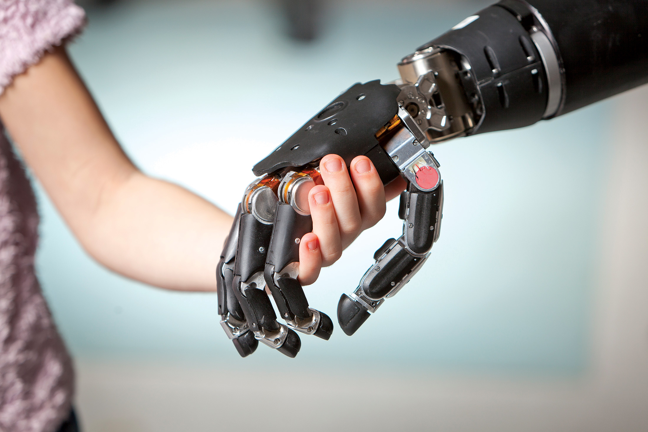 Pin by DON Young on Ref_Robotic arm | Prosthetics, Prosthetic arm