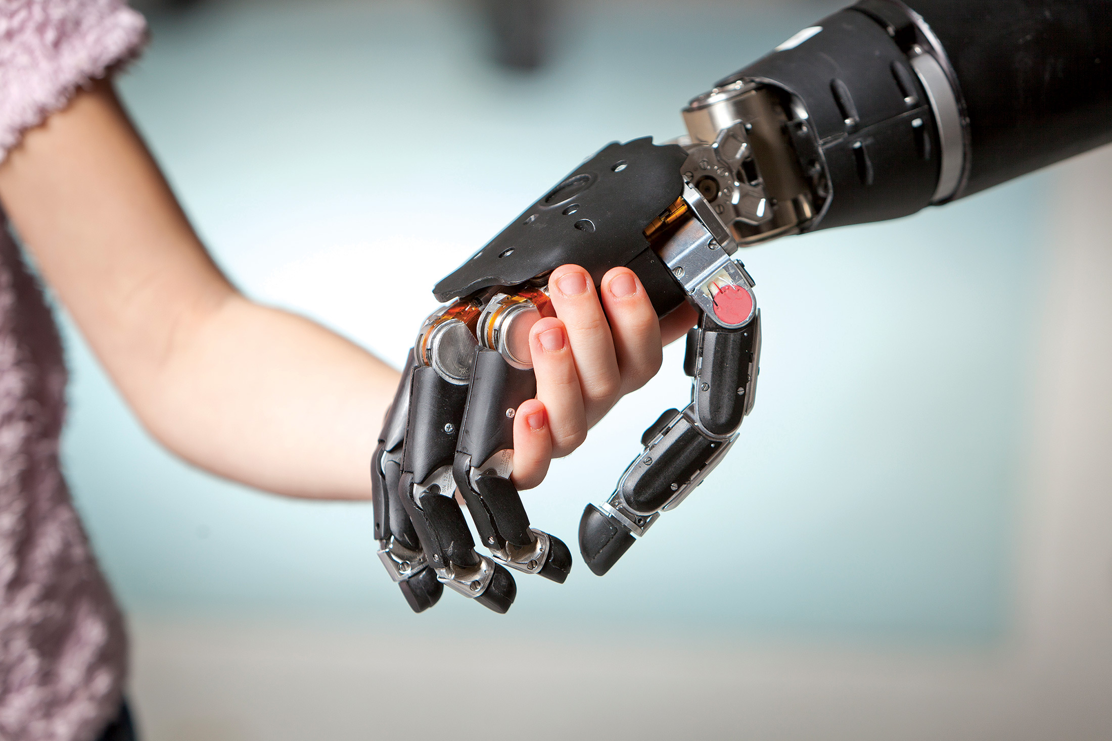 a-prosthetic-arm-that-gives-amputees-the-sense-of-touch-bloomberg