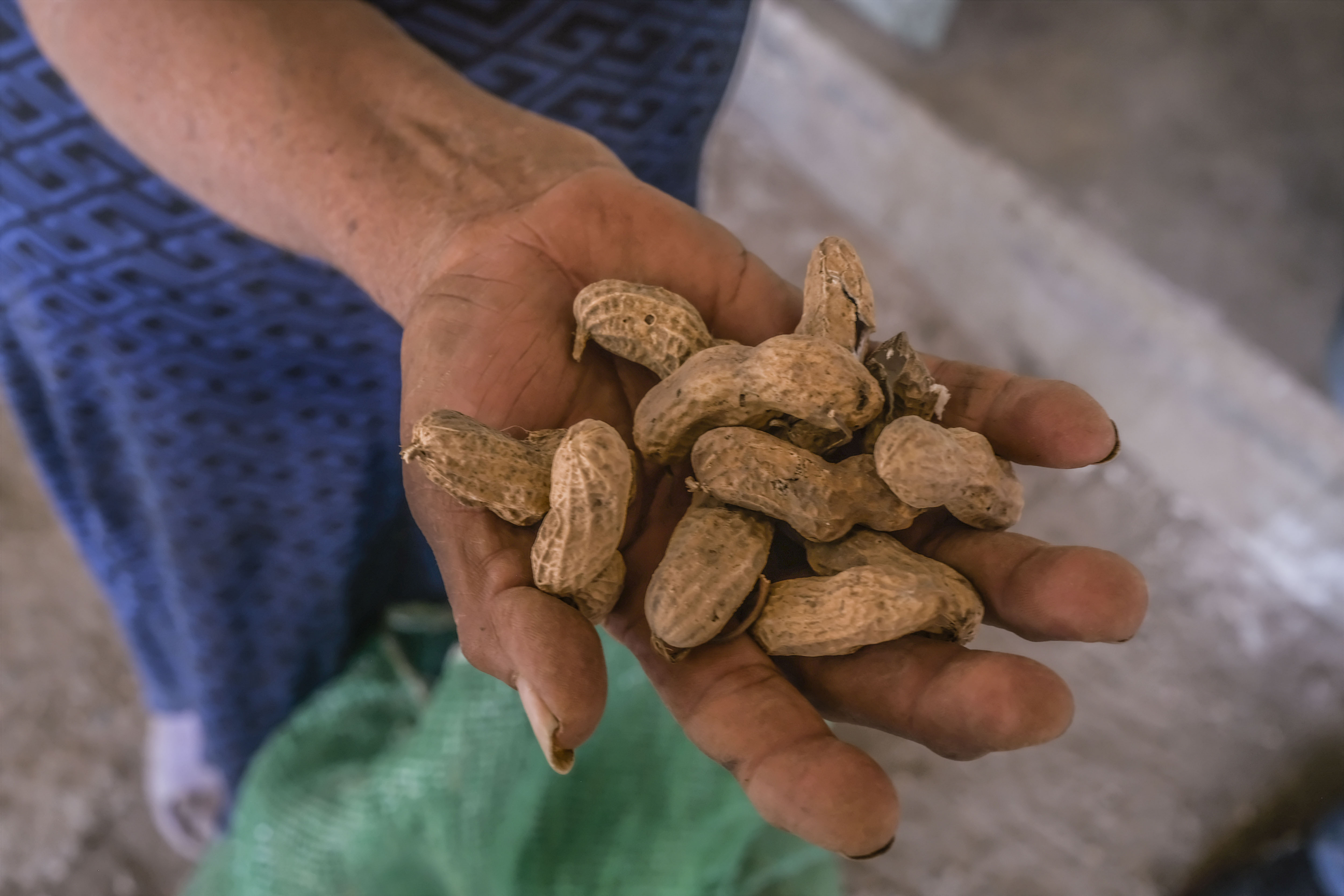 Peanut Allergy Symptoms in Toddlers Eased by Viaskin Skin Patch (DBV) Bloomberg