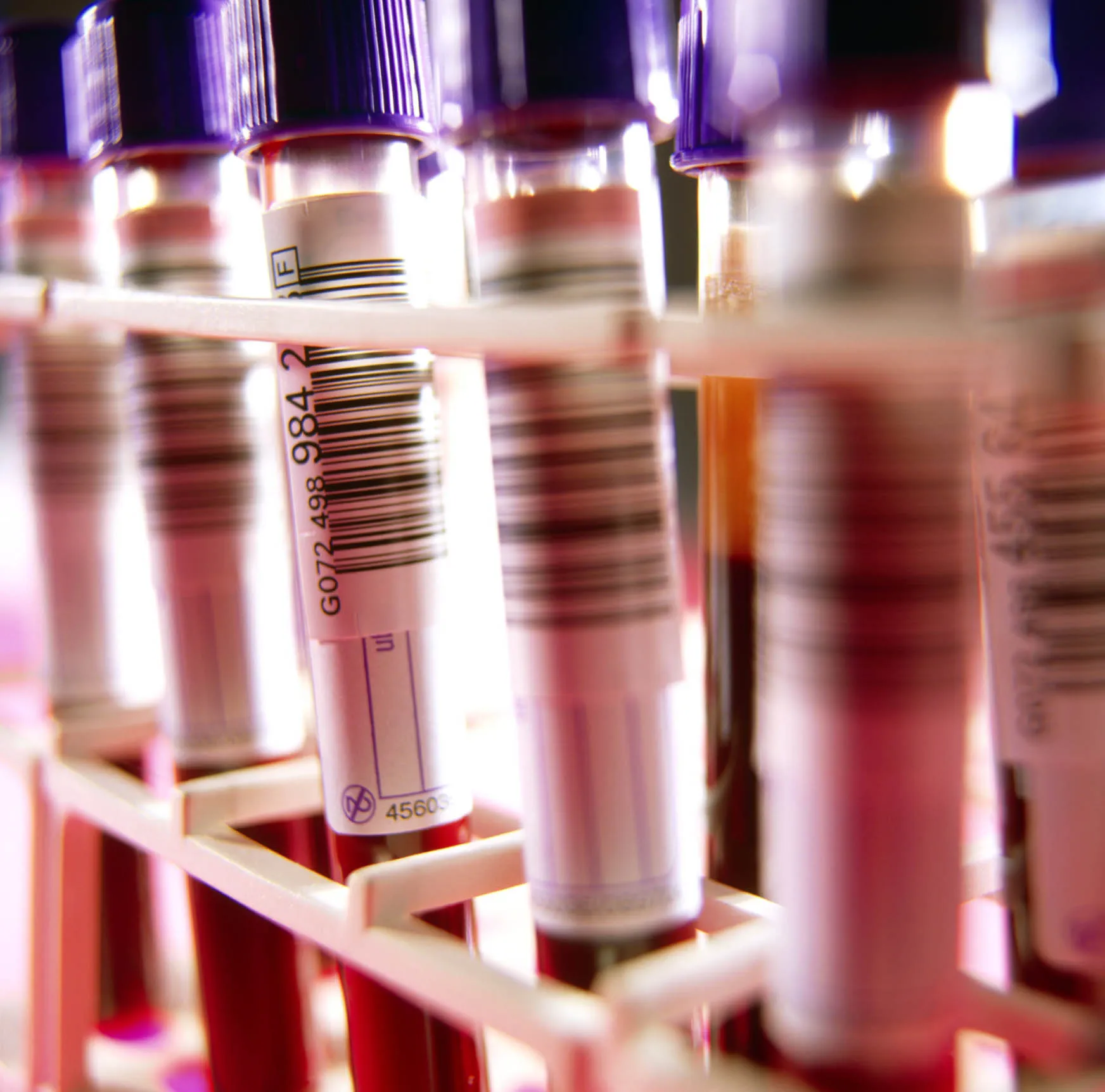 Row of test tube with blood samples
