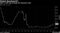 Global Benchmark?
