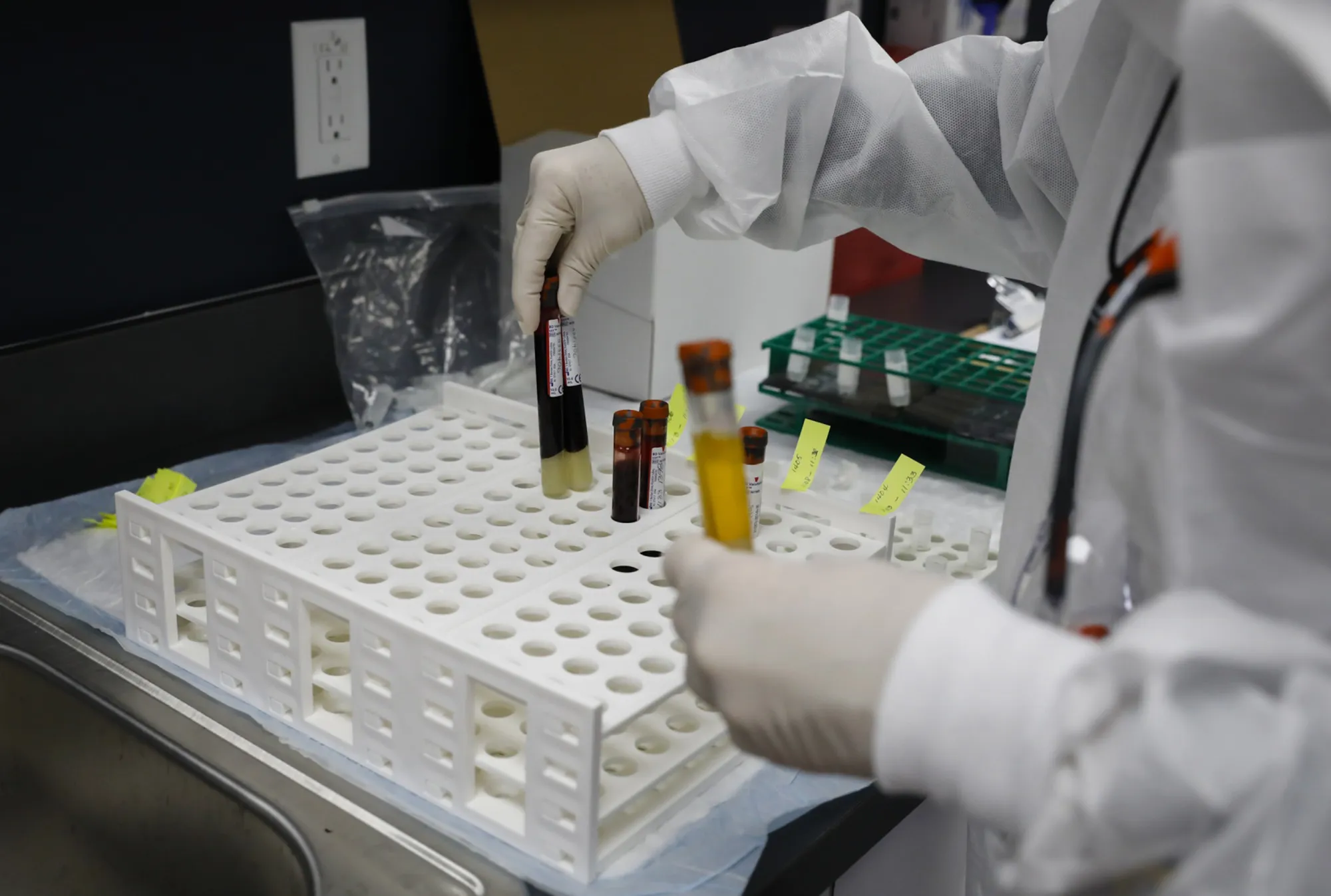 A health worker holds blood samples during clinical trials for a Covid-19 vaccine in Hollywood, Florida.