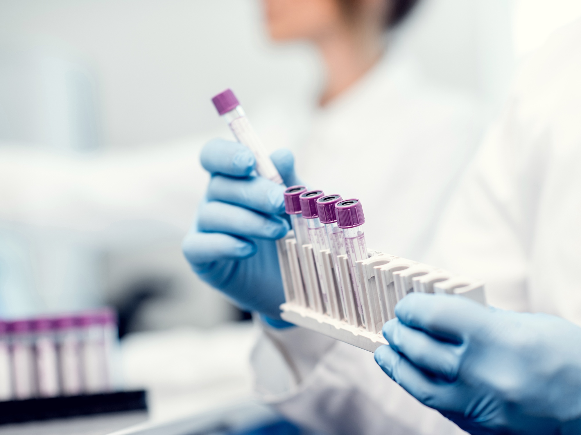 FDA Approving Drugs at Breakneck Speed, Raising Alarm - Bloomberg