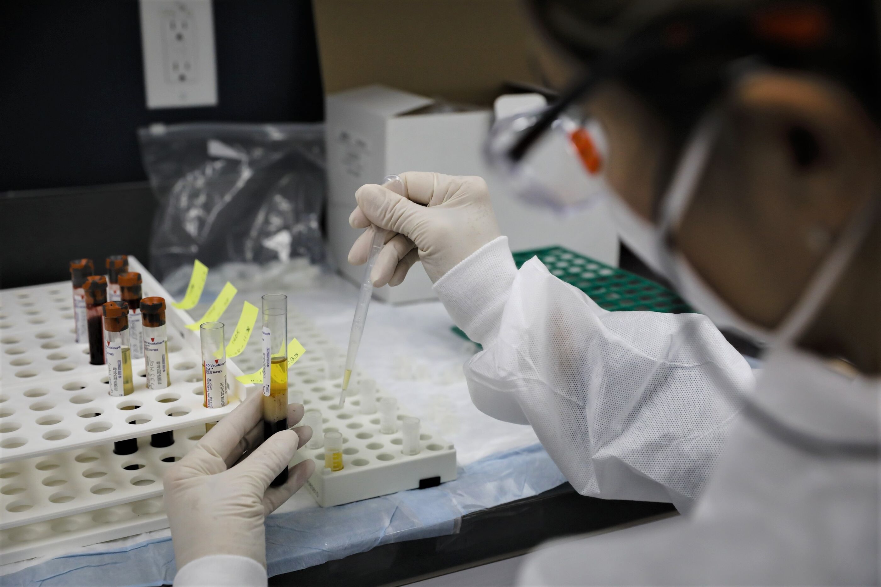 A person with eyedropper is distributing yellow liquid into small vials.