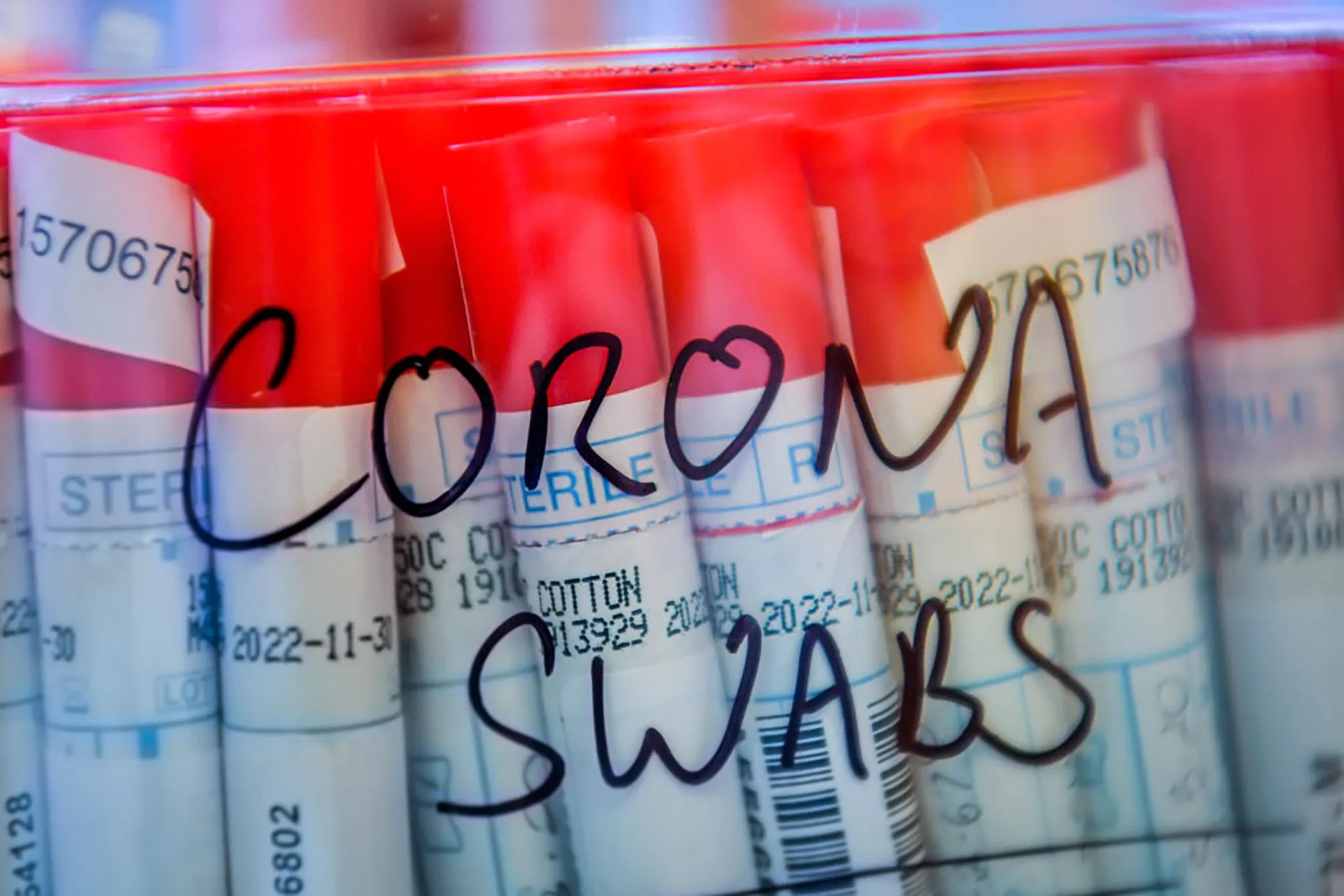 Coronavirus swabs from patients are kept in a plastic sealed tub as lab technicians carry out a diagnostic tests.