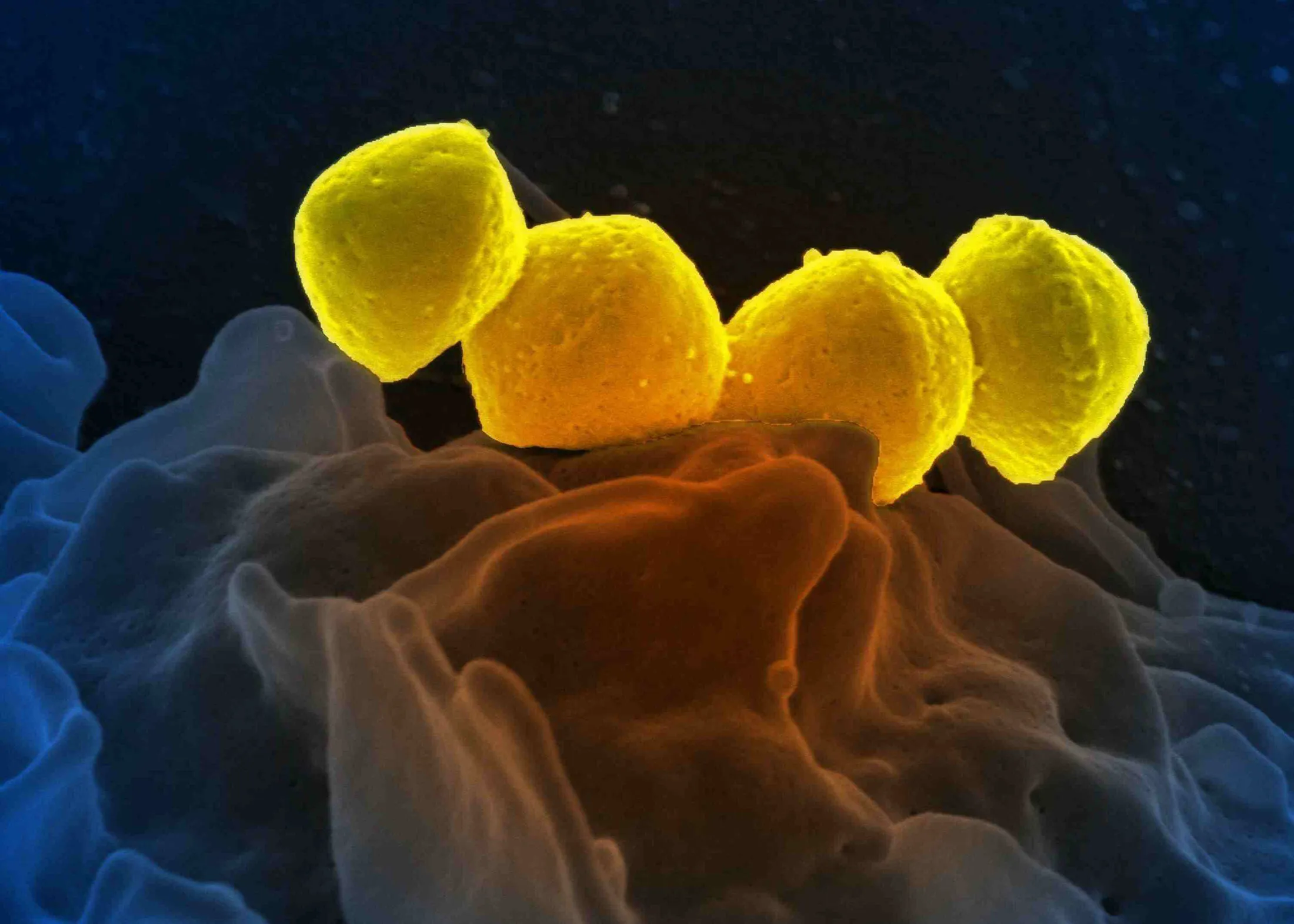 Scanning electron micrograph of Group A Streptococcus (Streptococcus pyogenes) bacteria.