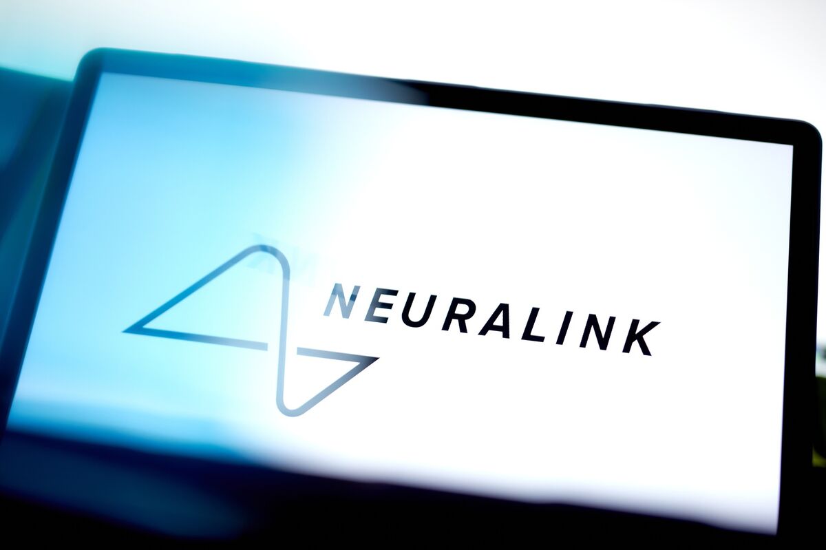 China's Brain Startups Take On Musk's Neuralink