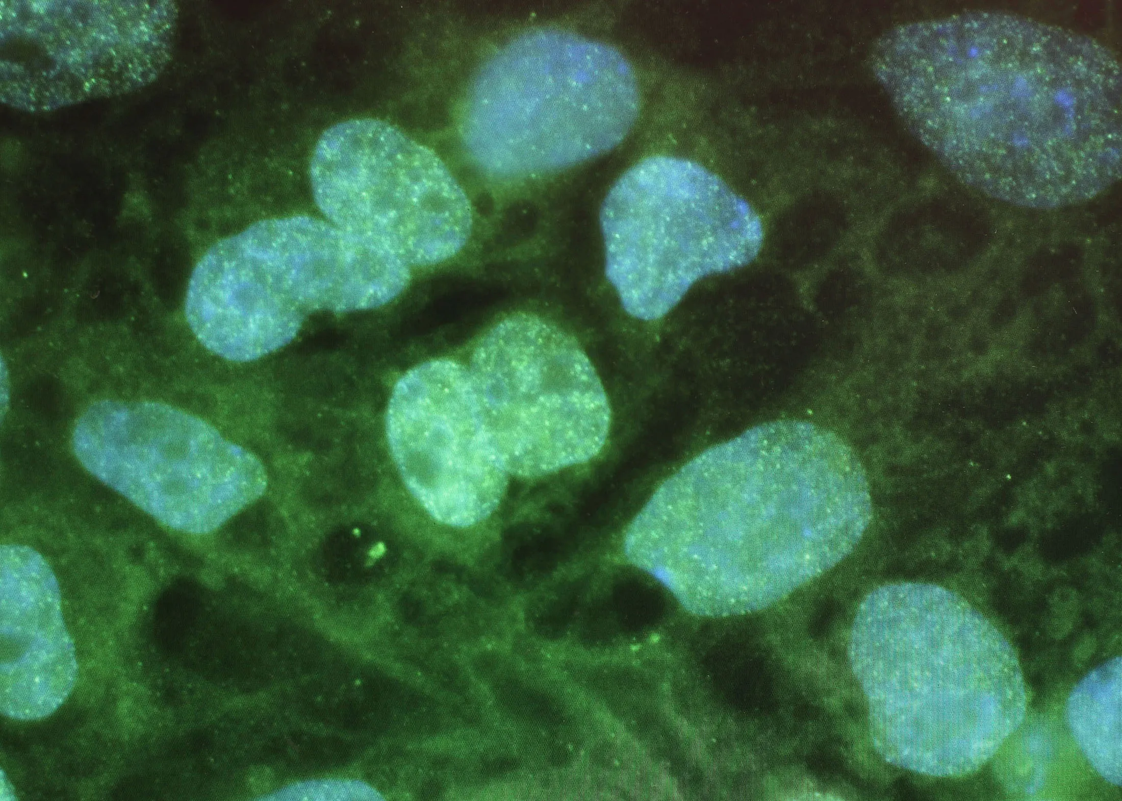 Stem cells are seen as a promising treatment for knee injuries and osteoarthritis.