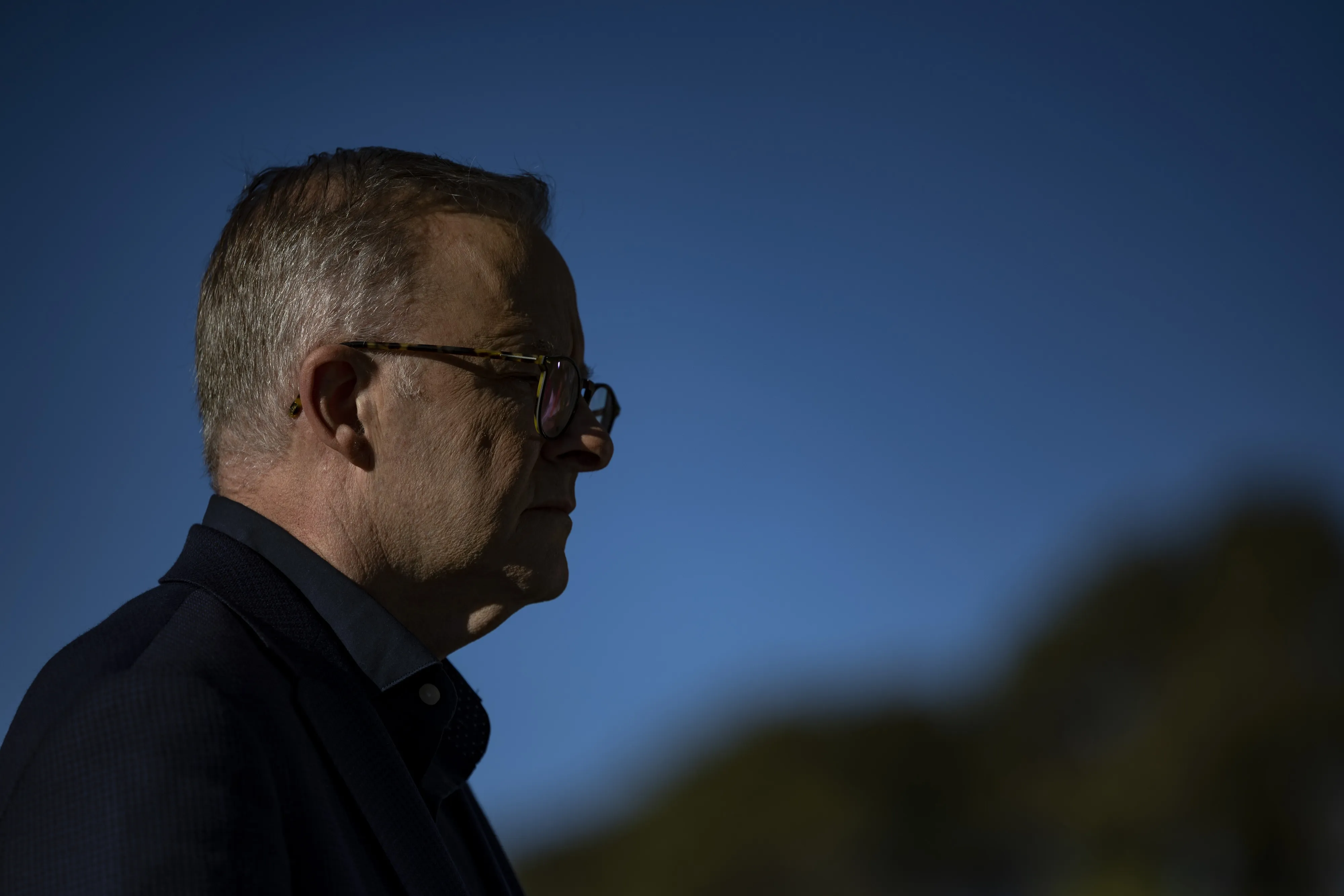 Anthony Albanese