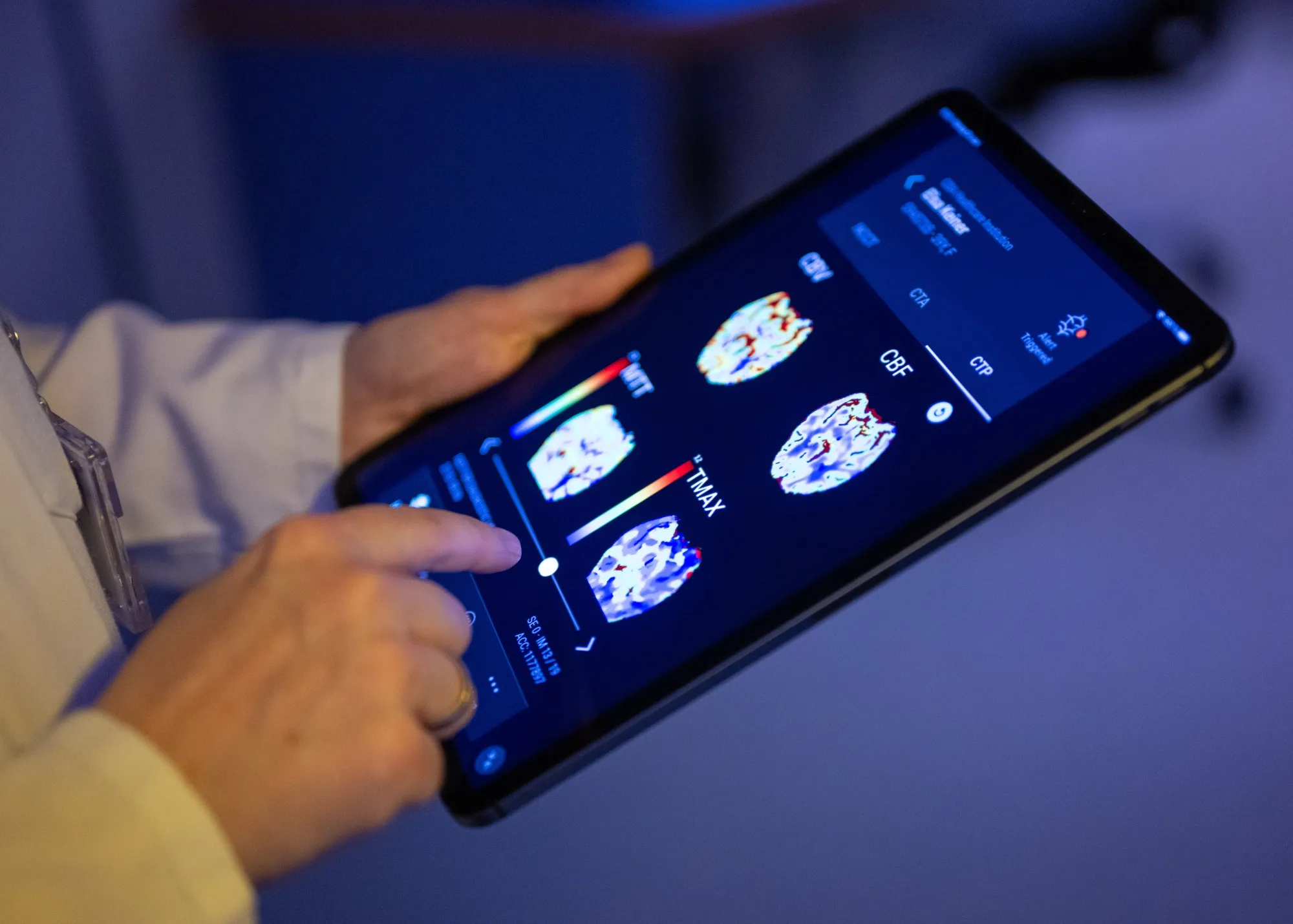 A radiologist looks at a patient's brain images in an AI-based app on a tablet.