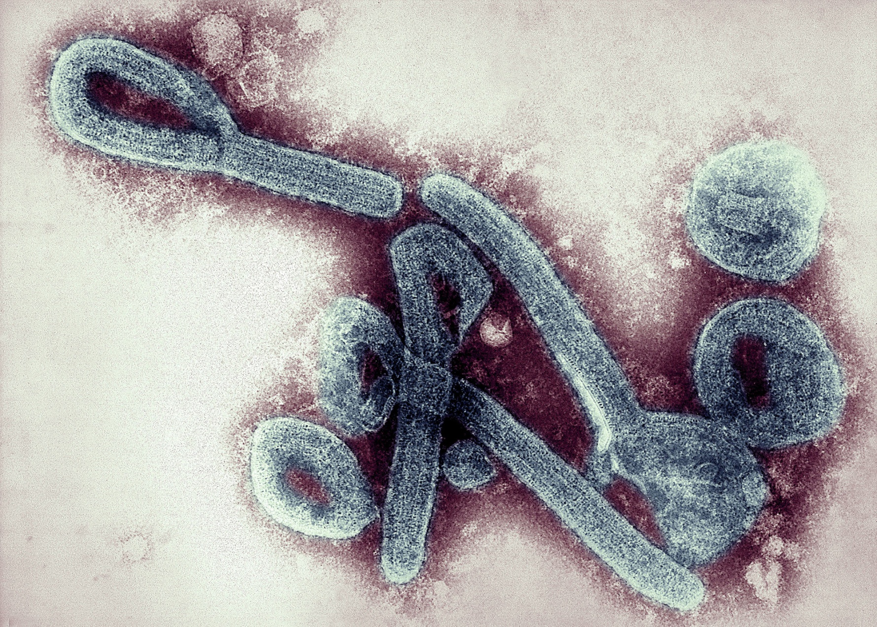 Guinea Declares End To Outbreak Of Marburg Hemorrhagic Fever Bloomberg