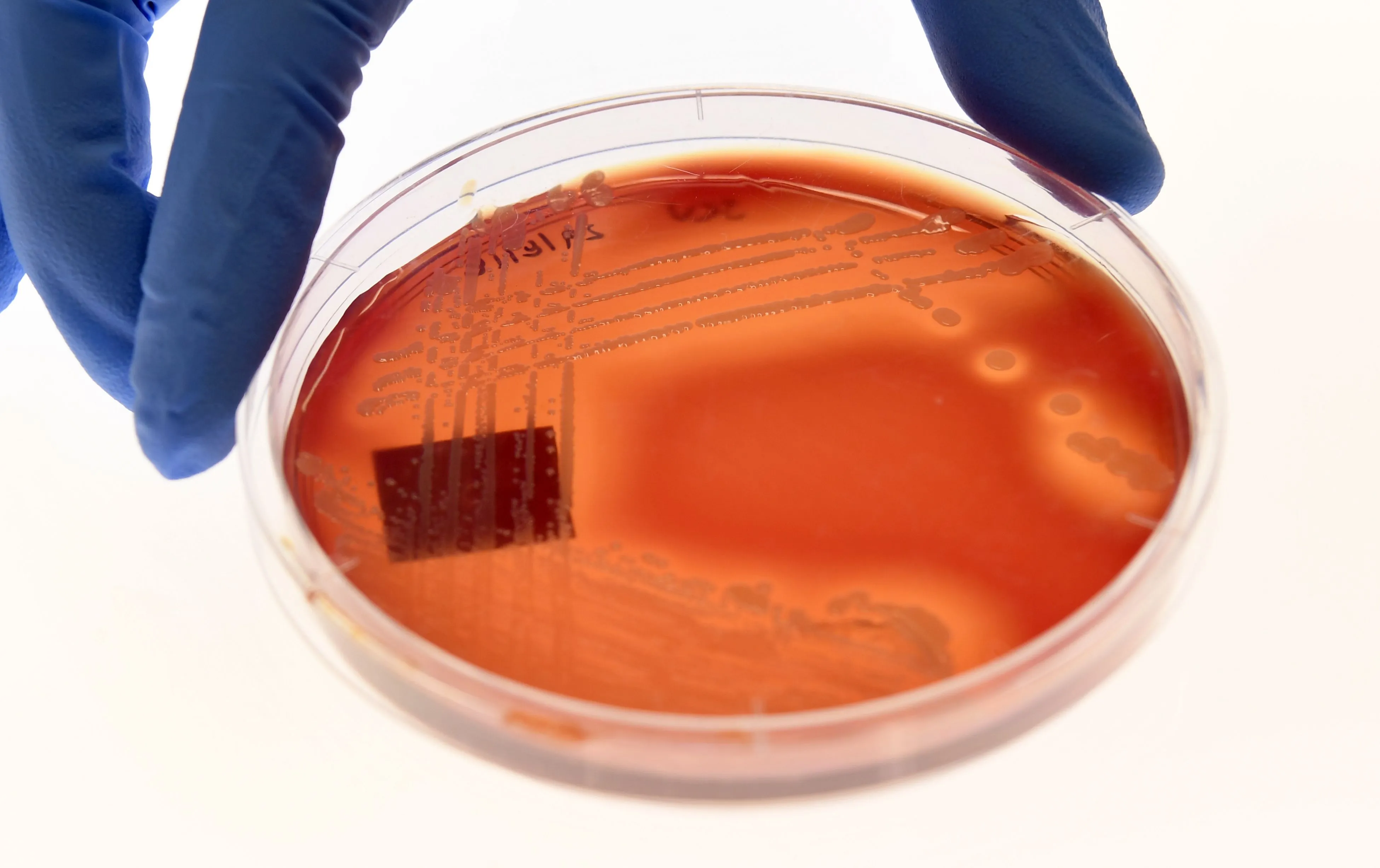 Antimicrobial resistance, which is also known as AMR and occurs when germs become resistant to drugs, is expected to worsen over the coming decades.