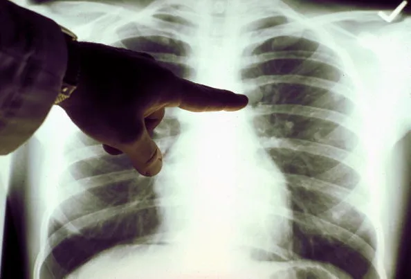A tumor is a trove of data.
