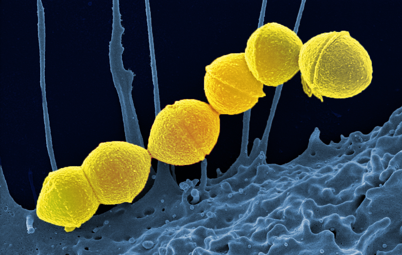 Group A Streptococcus.
