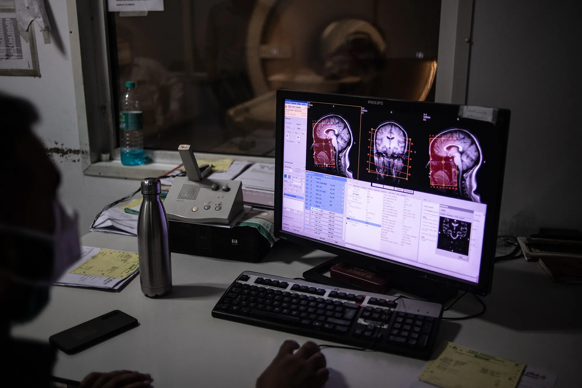 Startups working on brain implants and related technology have gained considerable momentum in recent months.