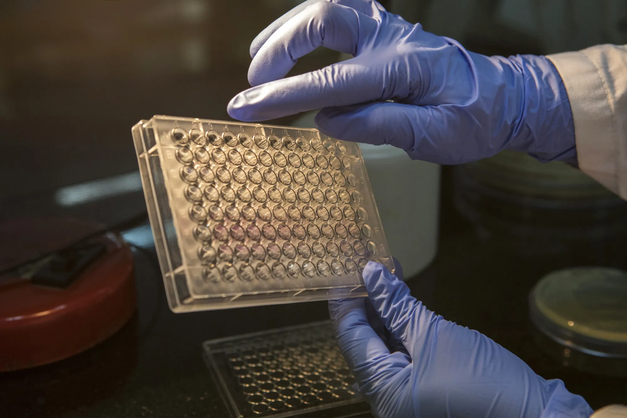 Samples are prepared in a test-tube tray at a laboratory